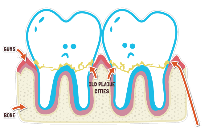 Old Plaque Cities Old Plaque Cities