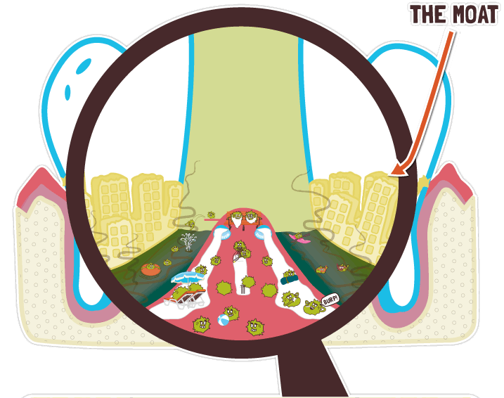 Close up of Plaque Moat Close up of Plaque Moat